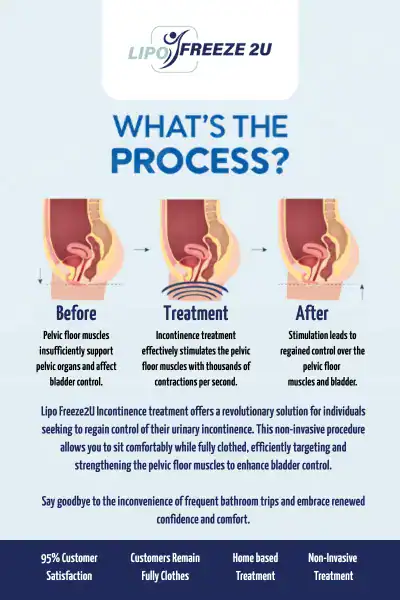 Diagram of how incontinence treatment Hitchin works.
