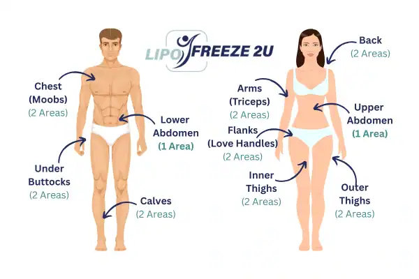 Areas you can have fat freezing treatment Hitchin