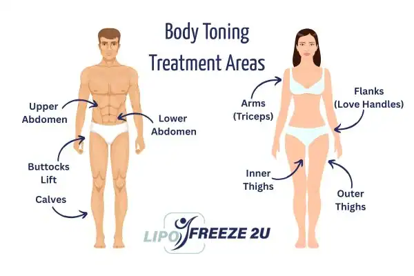 Graphic showing where you can have Body toning Treatment Hitchin on your body