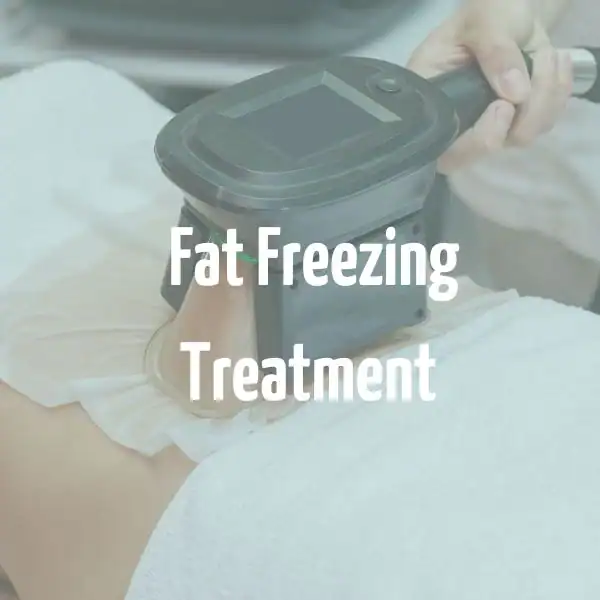 fat freezing treatment Hitchin