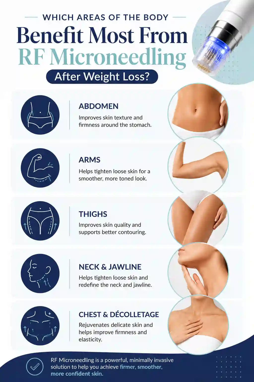 Which Areas of the Body Benefit Most From RF Microneedling After Weight Loss Hitchin